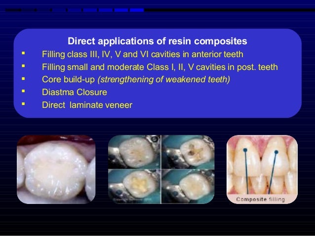 composite resin dental material composite resin
