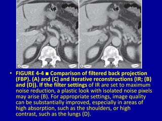 4 computed tomography Dr. Muhammad Bin Zulfiqar | PPT
