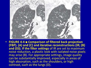 4 computed tomography Dr. Muhammad Bin Zulfiqar | PPT