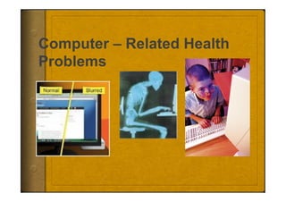 Computer – Related Health
Problems
 