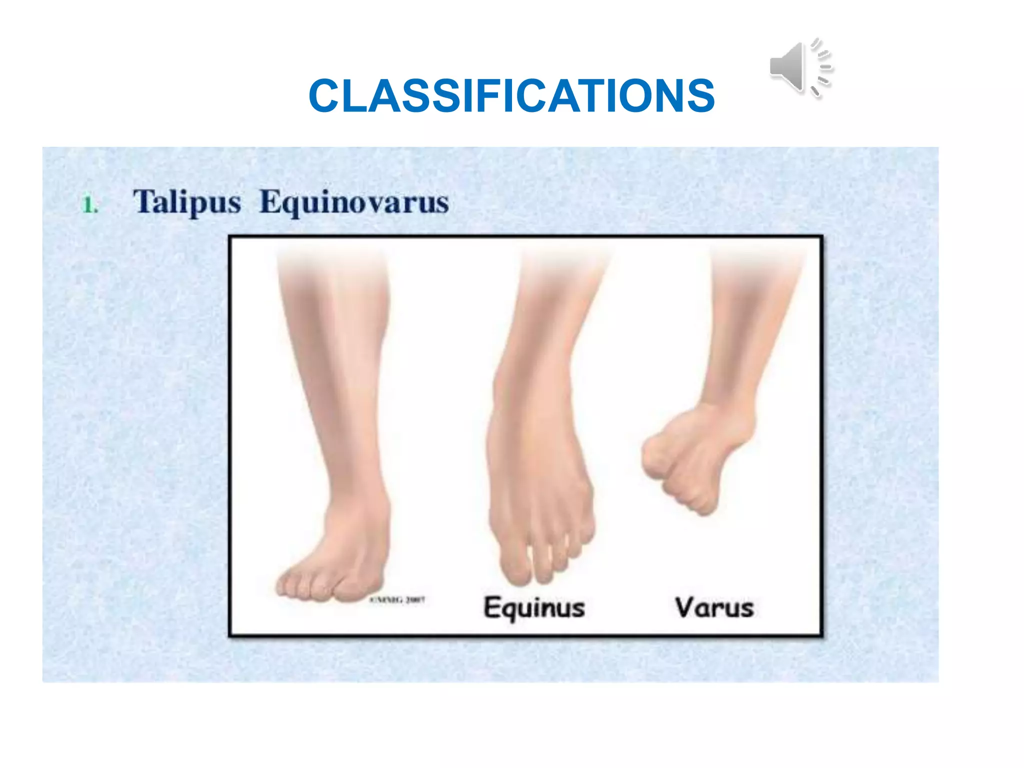 congenital-disorders-in-musculoskeletal-system-pptx
