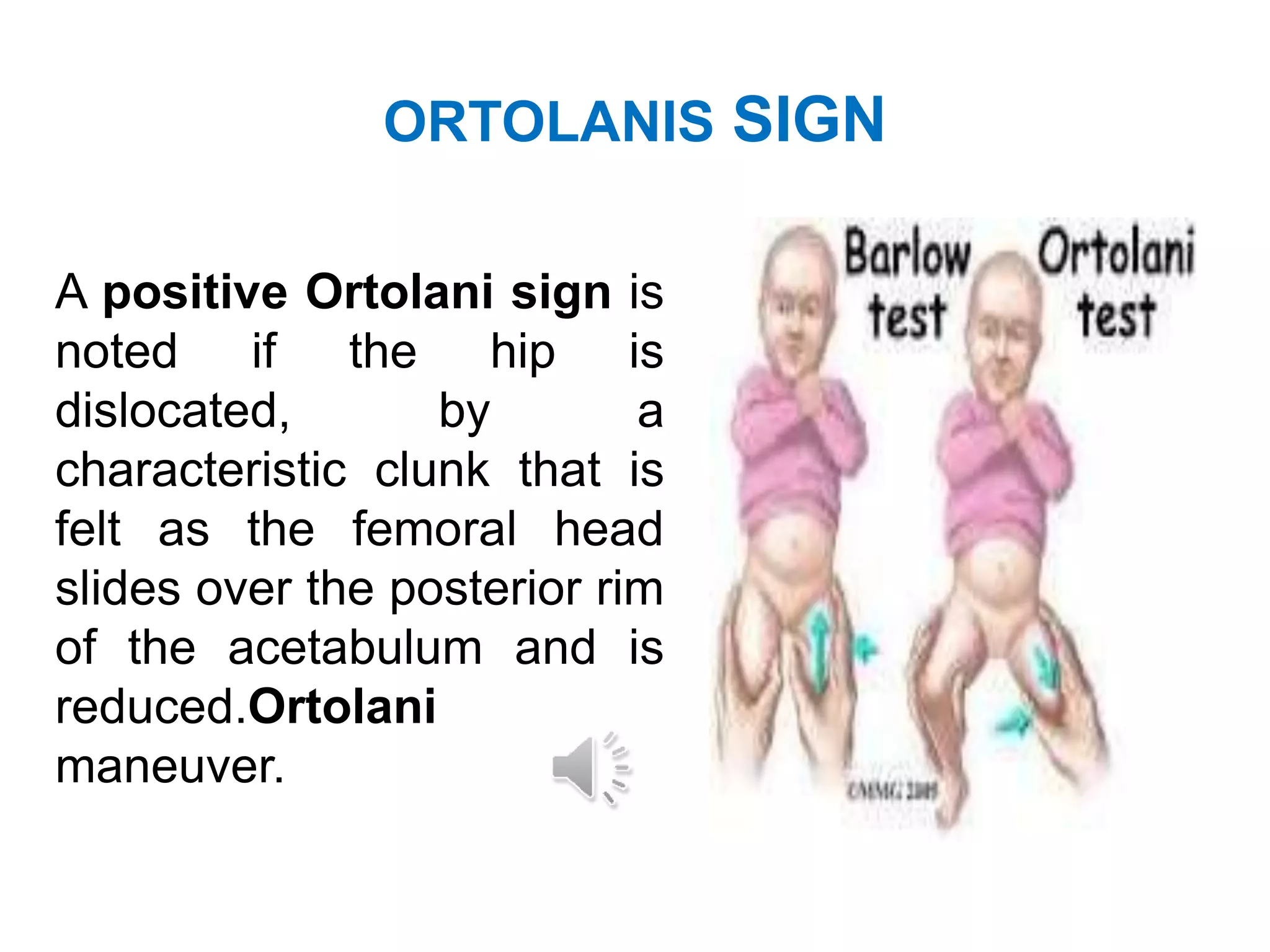 CONGENITAL DISORDERS IN MUSCULOSKELETAL SYSTEM | PPTX