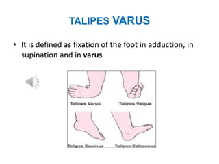 CONGENITAL DISORDERS IN MUSCULOSKELETAL SYSTEM | PPTX