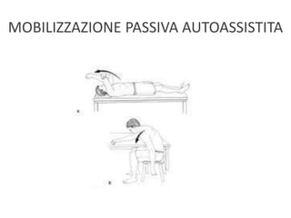 MOBILIZZAZIONE PASSIVA AUTOASSISTITA
 