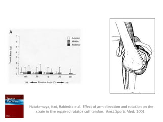Hatakemaya, Itoi, Rabindra e al. Effect of arm elevation and rotation on the
strain in the repaired rotator cuff tendon. Am.J.Sports Med. 2001
 