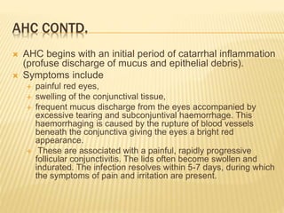AHC CONTD.
 AHC begins with an initial period of catarrhal inflammation
(profuse discharge of mucus and epithelial debris).
 Symptoms include
 painful red eyes,
 swelling of the conjunctival tissue,
 frequent mucus discharge from the eyes accompanied by
excessive tearing and subconjuntival haemorrhage. This
haemorrhaging is caused by the rupture of blood vessels
beneath the conjunctiva giving the eyes a bright red
appearance.
 These are associated with a painful, rapidly progressive
follicular conjunctivitis. The lids often become swollen and
indurated. The infection resolves within 5-7 days, during which
the symptoms of pain and irritation are present.
 