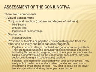 ASSESSMENT OF THE CONJUNCTIVA
There are 3 components
1, Visual assessment
 Conjunctival reaction ( pattern and degree of redness)
 Mild/Severe
 Diffuse/ local
 Ingestion or haemorrhage
 Discharge.
 Watery/purulent
 Presence of follicles or papillae - distinguishing one from the
other can be tricky and both can occur together.
 Papillae - occur in allergic, bacterial and gonococcal conjunctivitis.
They are formed when the conjunctival inflammation is effectively
limited by fibrous septa, so giving rise to the appearance of vascular
bulges. Generally found on the upper tarsal conjunctiva, they can
coalesce to form giant (cobblestone) papillae.
 Follicles - are more often associated with viral conjunctivitis. They
are lymphoid collections and are raised gelatinous pale bumps
(resembling small grains of rice). They tend to occur on the lower
tarsal conjunctiva and along the upper tarsal border.
 