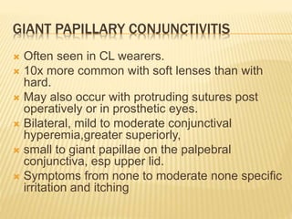 GIANT PAPILLARY CONJUNCTIVITIS
 Often seen in CL wearers.
 10x more common with soft lenses than with
hard.
 May also occur with protruding sutures post
operatively or in prosthetic eyes.
 Bilateral, mild to moderate conjunctival
hyperemia,greater superiorly,
 small to giant papillae on the palpebral
conjunctiva, esp upper lid.
 Symptoms from none to moderate none specific
irritation and itching
 