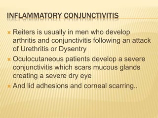 INFLAMMATORY CONJUNCTIVITIS
 Reiters is usually in men who develop
arthritis and conjunctivitis following an attack
of Urethritis or Dysentry
 Oculocutaneous patients develop a severe
conjunctivitis which scars mucous glands
creating a severe dry eye
 And lid adhesions and corneal scarring..
 