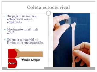 Coleta ectocervical
 Raspagem na mucosa
ectocervical com a
espátula.
 Movimento rotativo de
360º .
 Estender o material na
lâmina com suave pressão.
 