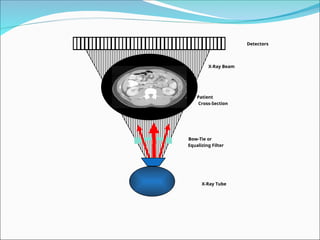 4 CT instrumentation Radiation CT scan Lecture | PPT