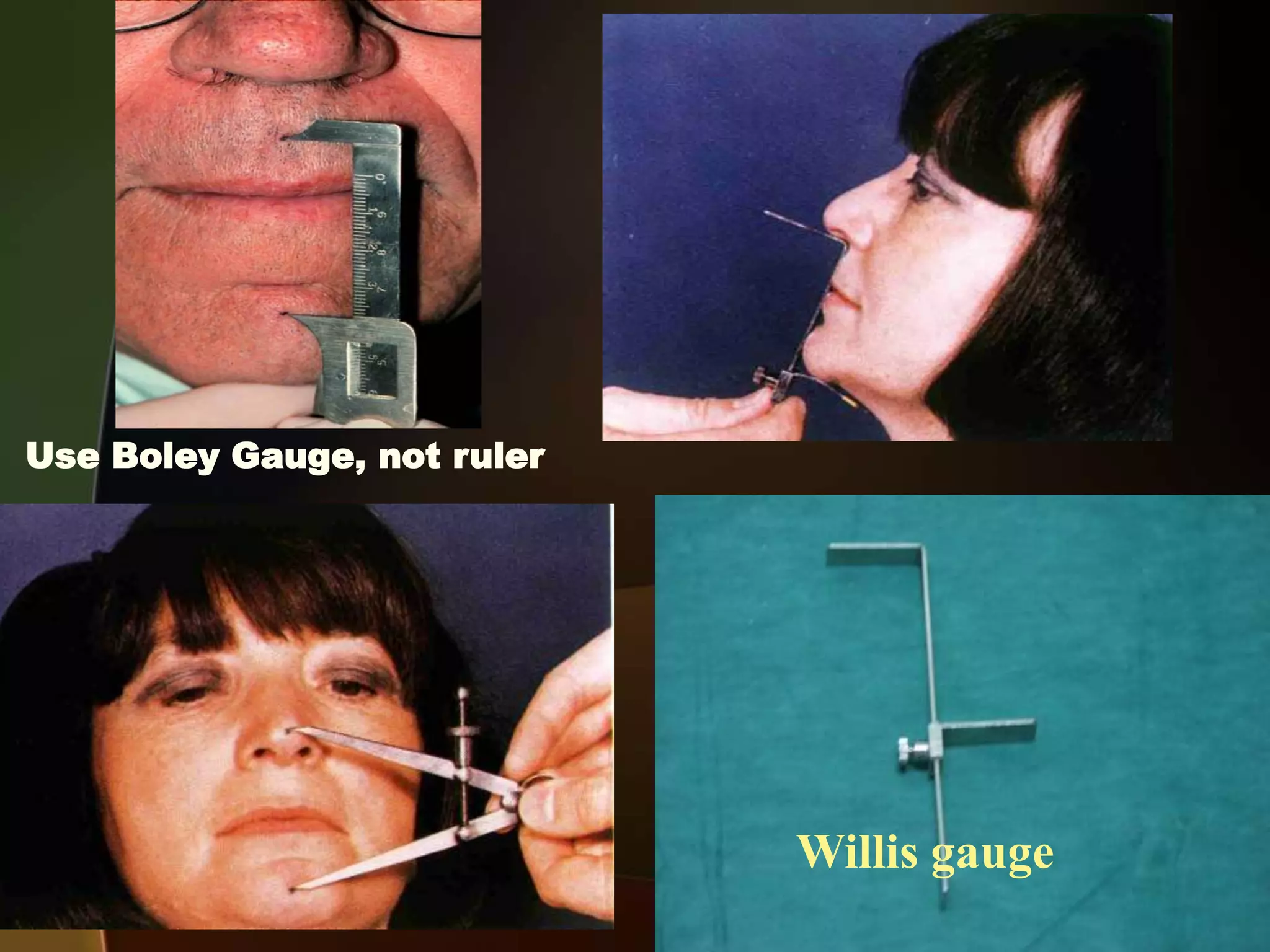 Clinical Steps for Complete Denture Construction Steps of recording