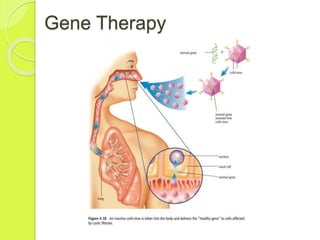 Gene Therapy 
 