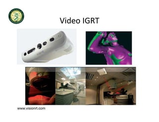 Video IGRT
                   Video IGRT




www.visionrt.com
 
