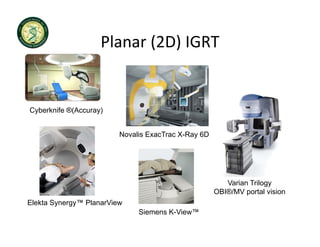 Planar (2D) IGRT
                    Planar (2D) IGRT


Cyberknife ®(Accuray)
C b k if ®(A        )


                         Novalis ExacTrac X-Ray 6D




                                                        Varian Trilogy
                                                     OBI®/MV portal vision
Elekta Synergy™ PlanarVie
       S nerg ™ PlanarView
                              Siemens K-View™
 