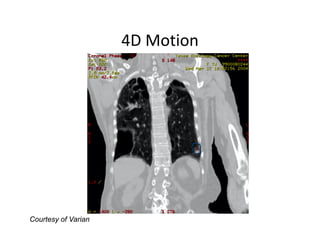 4D Motion
                     4D Motion




Courtesy of Varian
 