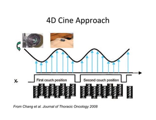 4D Cine Approach
                    4D Cine Approach




From Chang et al. Journal of Thoracic Oncology 2008
 