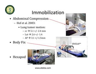 Immobilization
• Abdominal Compression
  – Hof et al 2003:
    Hof et al. 2003:
     • Lung tumor motion: 
        – cc  5.1 +/‐ 2.4 mm
        – Lat  2.6 +/‐ 1.4
        – AP  3.1 +/‐1.5mm
• B d Fi
  Body Fix



• Hexapod


                  www.elekta.com
 