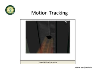 Motion Tracking
Motion Tracking




                  www.varian.com
 
