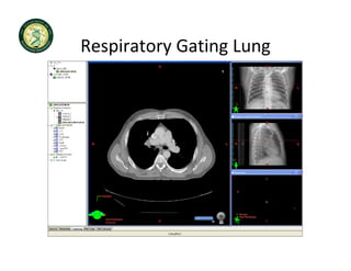 Respiratory Gating Lung
Respiratory Gating Lung
 