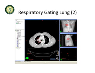 Respiratory Gating Lung (2)
Respiratory Gating Lung (2)
 