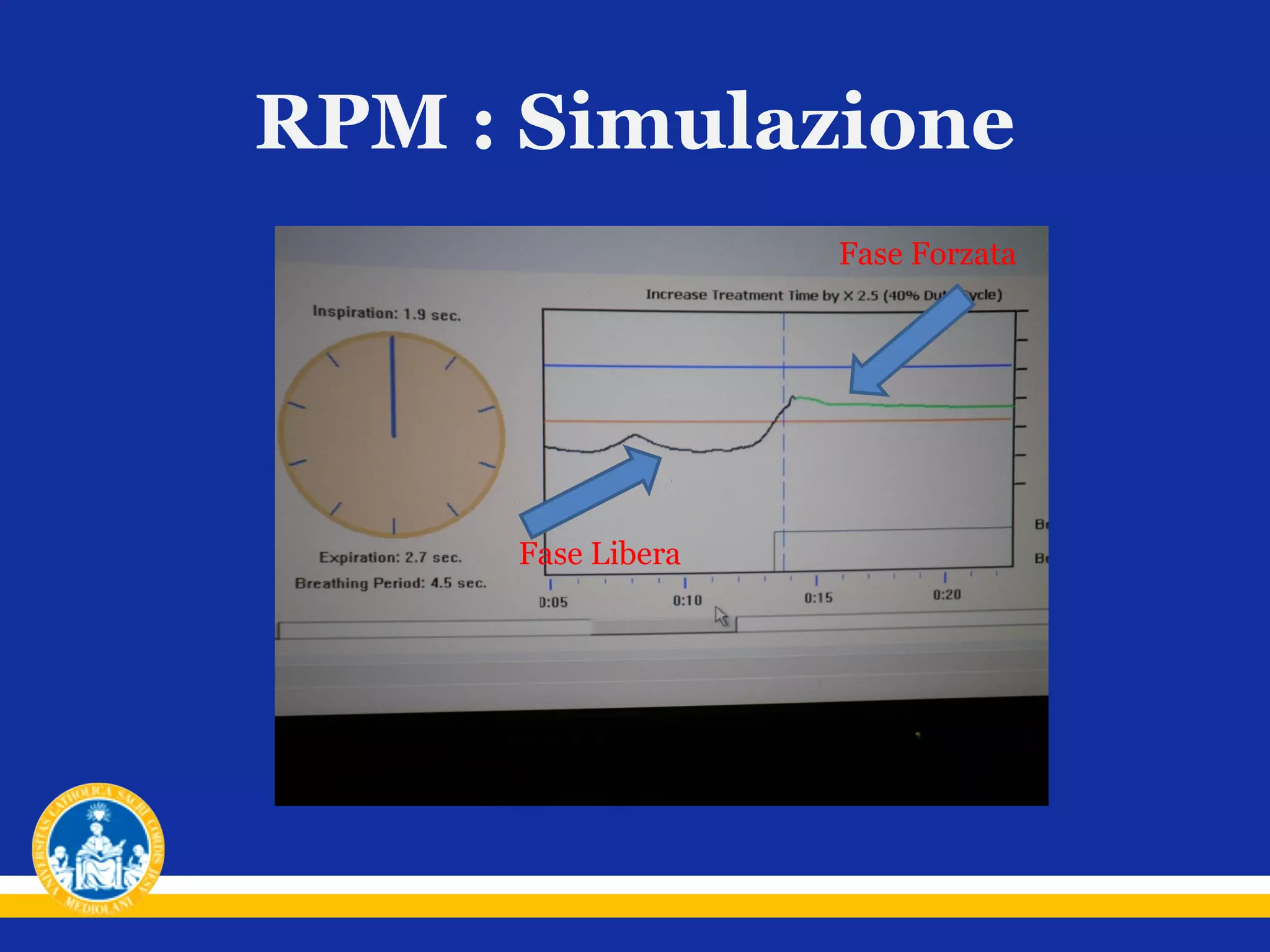 RPM : Simulazione
Fase Forzata

Fase Libera

 