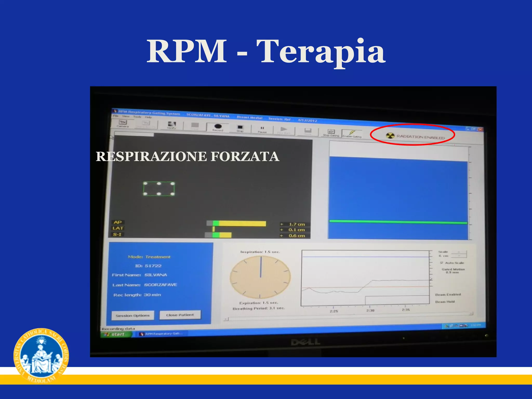 RPM - Terapia
RESPIRAZIONE FORZATA

 
