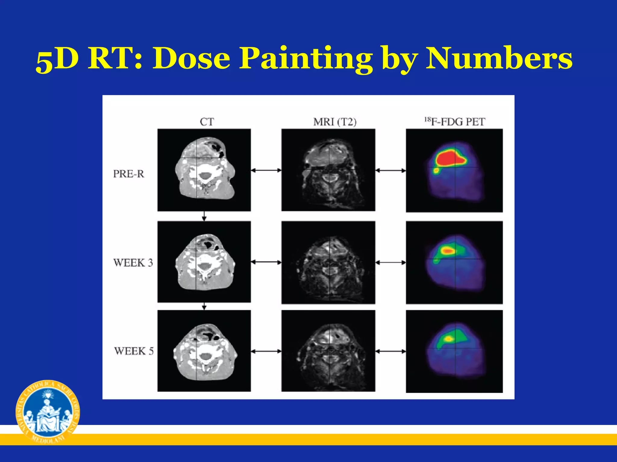 5D RT: Dose Painting by Numbers

 
