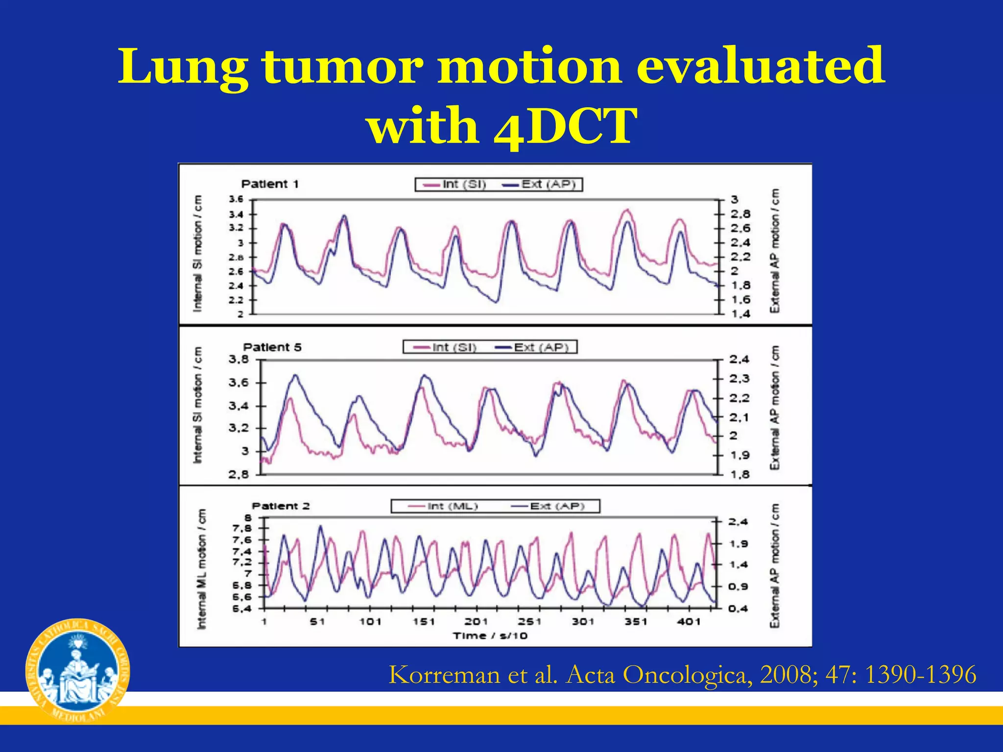 Lung tumor motion evaluated
with 4DCT

Korreman et al. Acta Oncologica, 2008; 47: 1390-1396

 