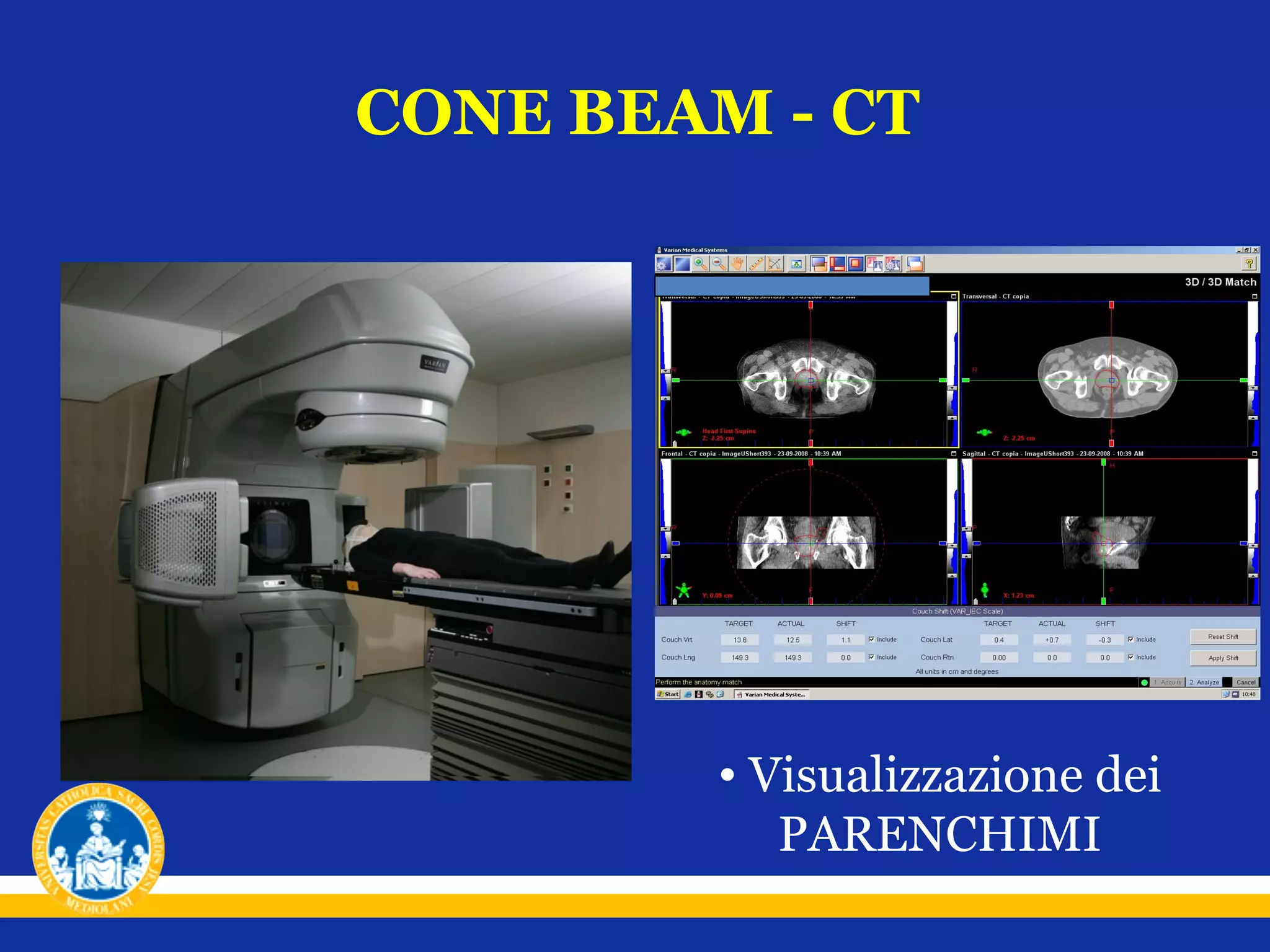 CONE BEAM - CT

• Visualizzazione dei
PARENCHIMI

 