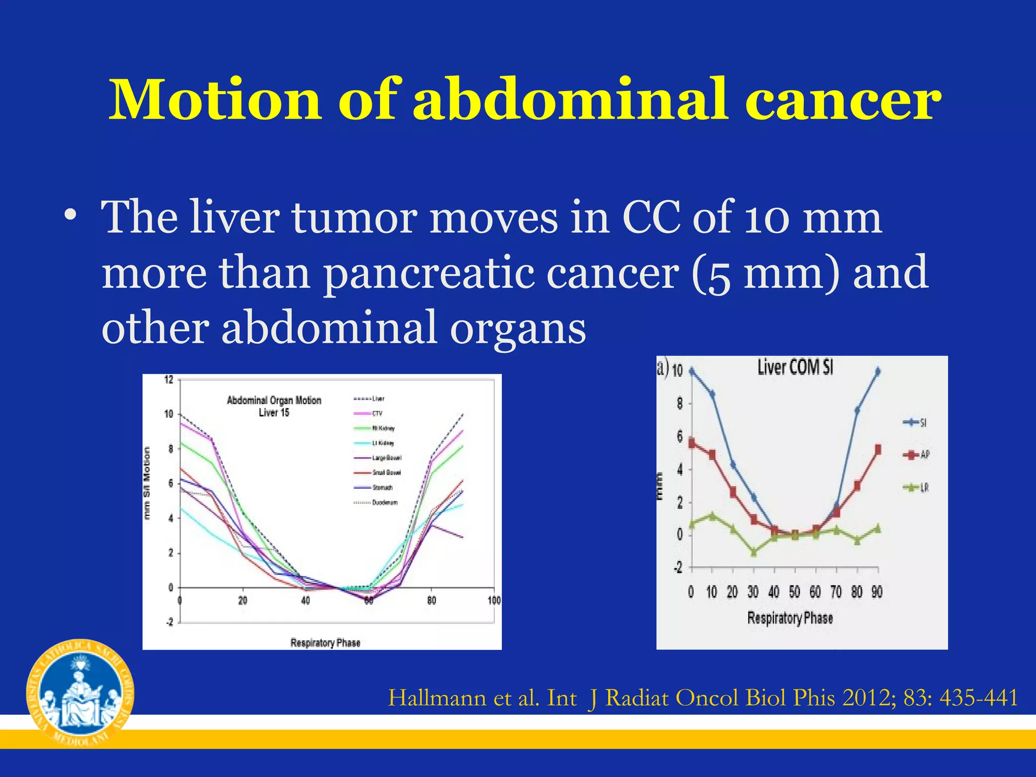 Motion of abdominal cancer
• The liver tumor moves in CC of 10 mm
more than pancreatic cancer (5 mm) and
other abdominal organs

Hallmann et al. Int J Radiat Oncol Biol Phis 2012; 83: 435-441

 