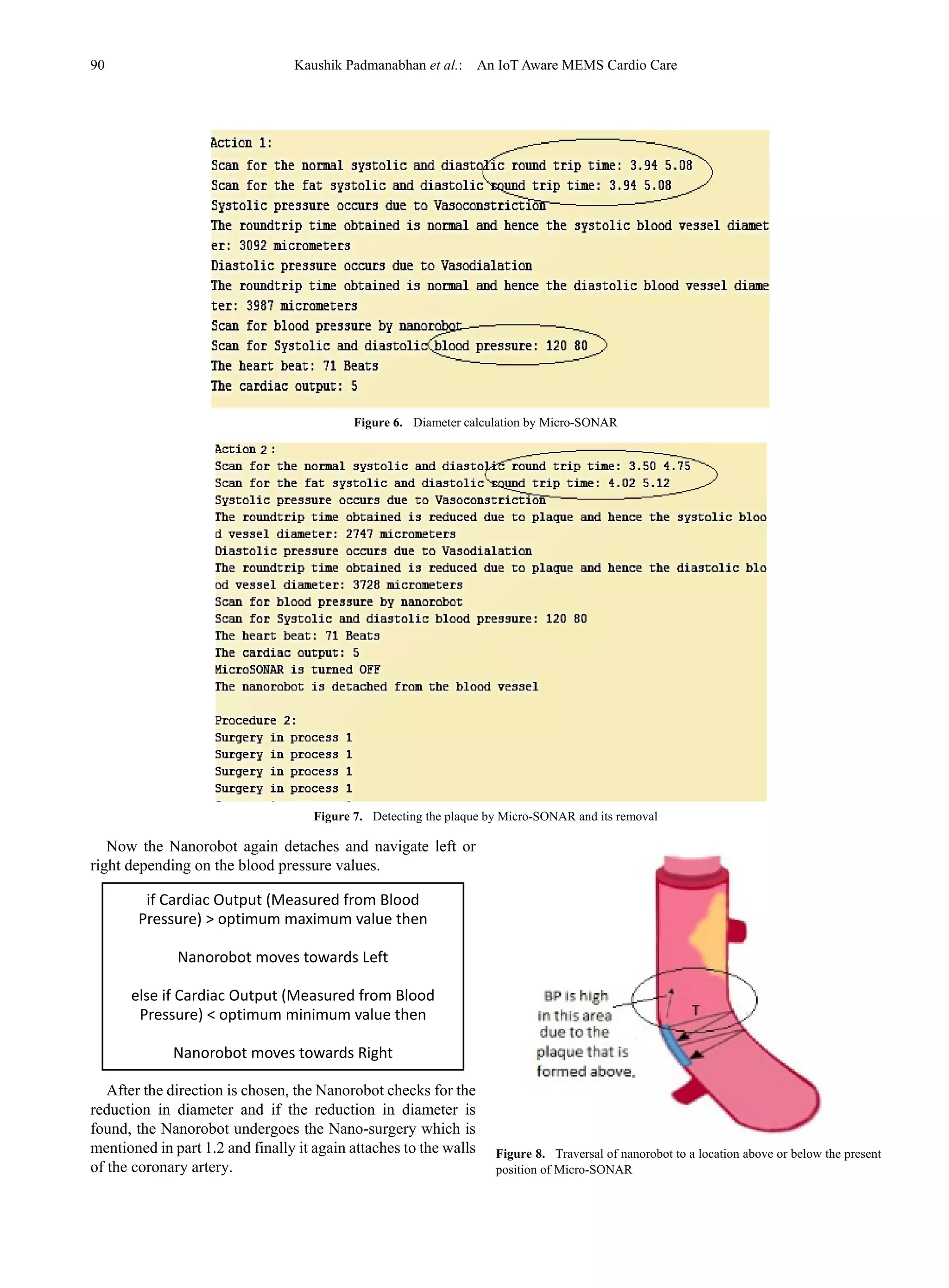 90 Kaushik Padmanabhan et al.: An IoT Aware MEMS Cardio Care
Figure 6. Diameter calculation by Micro-SONAR
Figure 7. Detecting the plaque by Micro-SONAR and its removal
Now the Nanorobot again detaches and navigate left or
right depending on the blood pressure values.
After the direction is chosen, the Nanorobot checks for the
reduction in diameter and if the reduction in diameter is
found, the Nanorobot undergoes the Nano-surgery which is
mentioned in part 1.2 and finally it again attaches to the walls
of the coronary artery.
Figure 8. Traversal of nanorobot to a location above or below the present
position of Micro-SONAR
if Cardiac Output (Measured from Blood
Pressure) > optimum maximum value then
Nanorobot moves towards Left
else if Cardiac Output (Measured from Blood
Pressure) < optimum minimum value then
Nanorobot moves towards Right
 