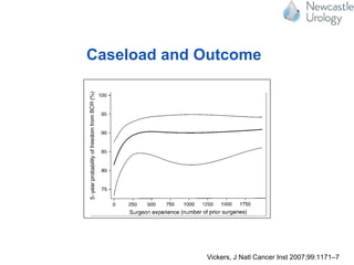 Caseload and Outcome
cancer, Gleason grade ≤6, and
clinically meaningful differen
homogenous group. Because
between surgeon experience
by the ability of individual su
capable surgeon who was u
therefore contribute to the be
ing curve), weperformed add
the sample to patients who
100 total surgeries and to pa
at least 250 total surgeries. C
results were unduly inﬂuenc
geons, we restricted the ana
completed the median num
Because there were some di
levels of surgeon experience,
addition, because it is possib
affected by differences in the
hormonal therapy before pat
cal recurrence, we performed
Fig. 2. The surgical learning curve for cancer control after radical pros-
tatectomy. Predicted probability (black curve) and 95% conﬁdence
intervals (gray curves) for freedom from biochemical recurrence (BCR)
at 5 years after radical prostatectomy are plotted against increasing
surgeon experience. Probabilities are for a patient with typical cancer
severity (mean prostate-speciﬁ c antigen level, pathologic stage, and
grade) treated in 1997 (approximately equal numbers of patients were
cancer, Gleason grade ≤6, and
clinically meaningful differen
homogenous group. Because
between surgeon experience
by the ability of individual su
capable surgeon who was un
therefore contribute to the be
ing curve), weperformed addi
the sample to patients whos
100 total surgeries and to pat
at least 250 total surgeries. C
results were unduly inﬂuence
geons, we restricted the anal
completed the median numb
Because there were some dif
levels of surgeon experience, w
addition, because it is possibl
affected by differences in the i
hormonal therapy before pati
cal recurrence, we performed
Fig. 2. The surgical learning curve for cancer control after radical pros-
tatectomy. Predicted probability (black curve) and 95% conﬁdence
intervals (gray curves) for freedom from biochemical recurrence (BCR)
at 5 years after radical prostatectomy are plotted against increasing
surgeon experience. Probabilities are for a patient with typical cancer
severity (mean prostate-speciﬁ c antigen level, pathologic stage, and
grade) treated in 1997 (approximately equal numbers of patients were
Vickers, J Natl Cancer Inst 2007;99:1171–7
 