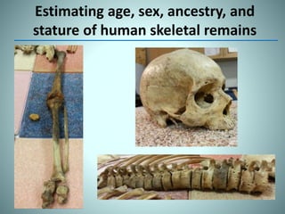 Estimating age, sex, ancestry, and
stature of human skeletal remains
 