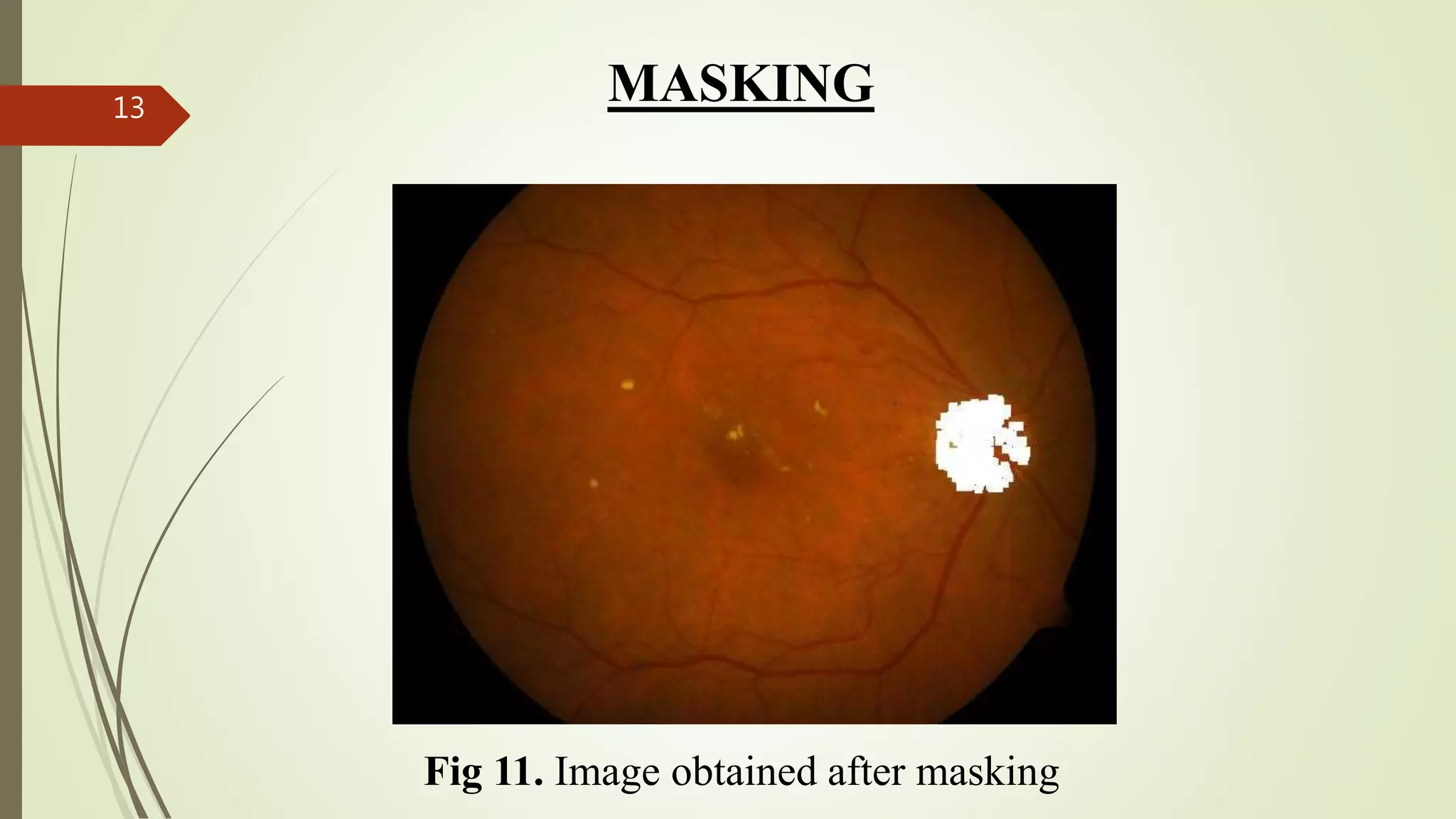 Fig 11. Image obtained after masking
MASKING13
 