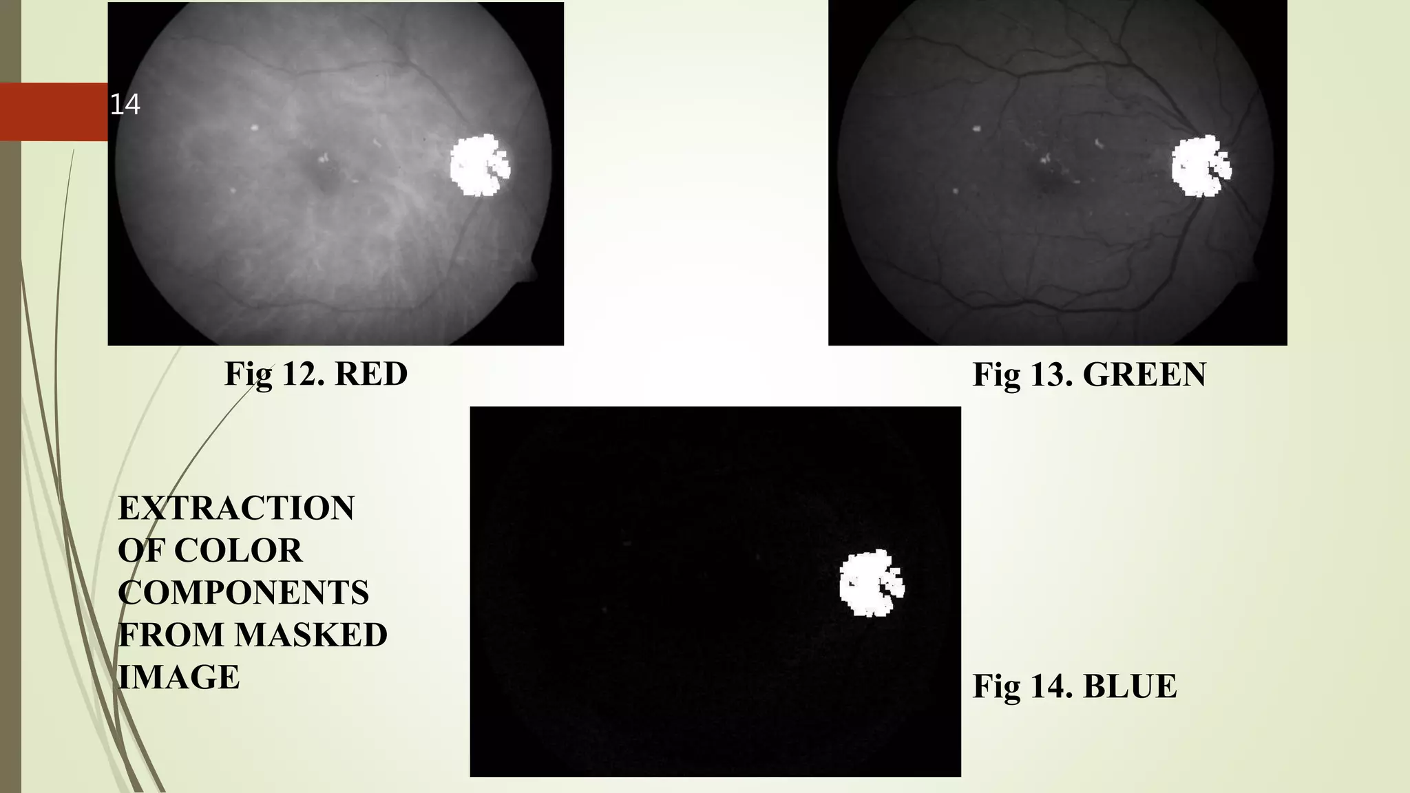 Fig 12. RED Fig 13. GREEN
Fig 14. BLUE
EXTRACTION
OF COLOR
COMPONENTS
FROM MASKED
IMAGE
14
 
