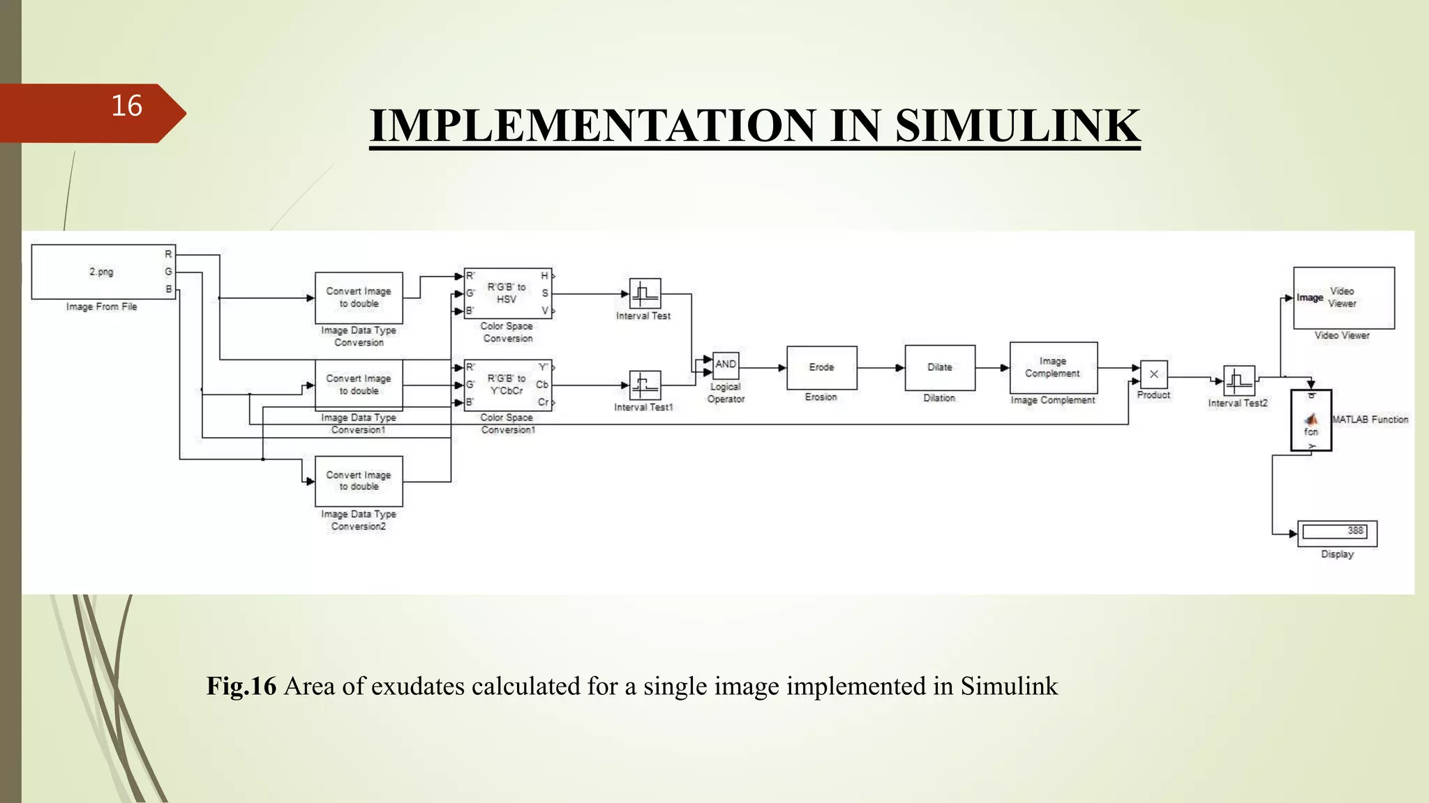 IMPLEMENTATION IN SIMULINK
Fig.16 Area of exudates calculated for a single image implemented in Simulink
16
 