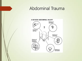 Pediatric Trauma | PPTX