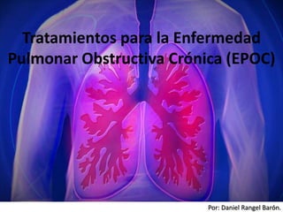 Por: Daniel Rangel Barón.
Tratamientos para la Enfermedad
Pulmonar Obstructiva Crónica (EPOC)
 