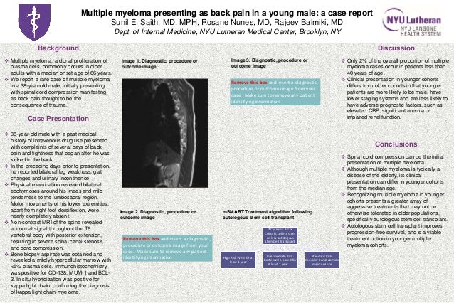 Multiple myeloma life expectancy picture