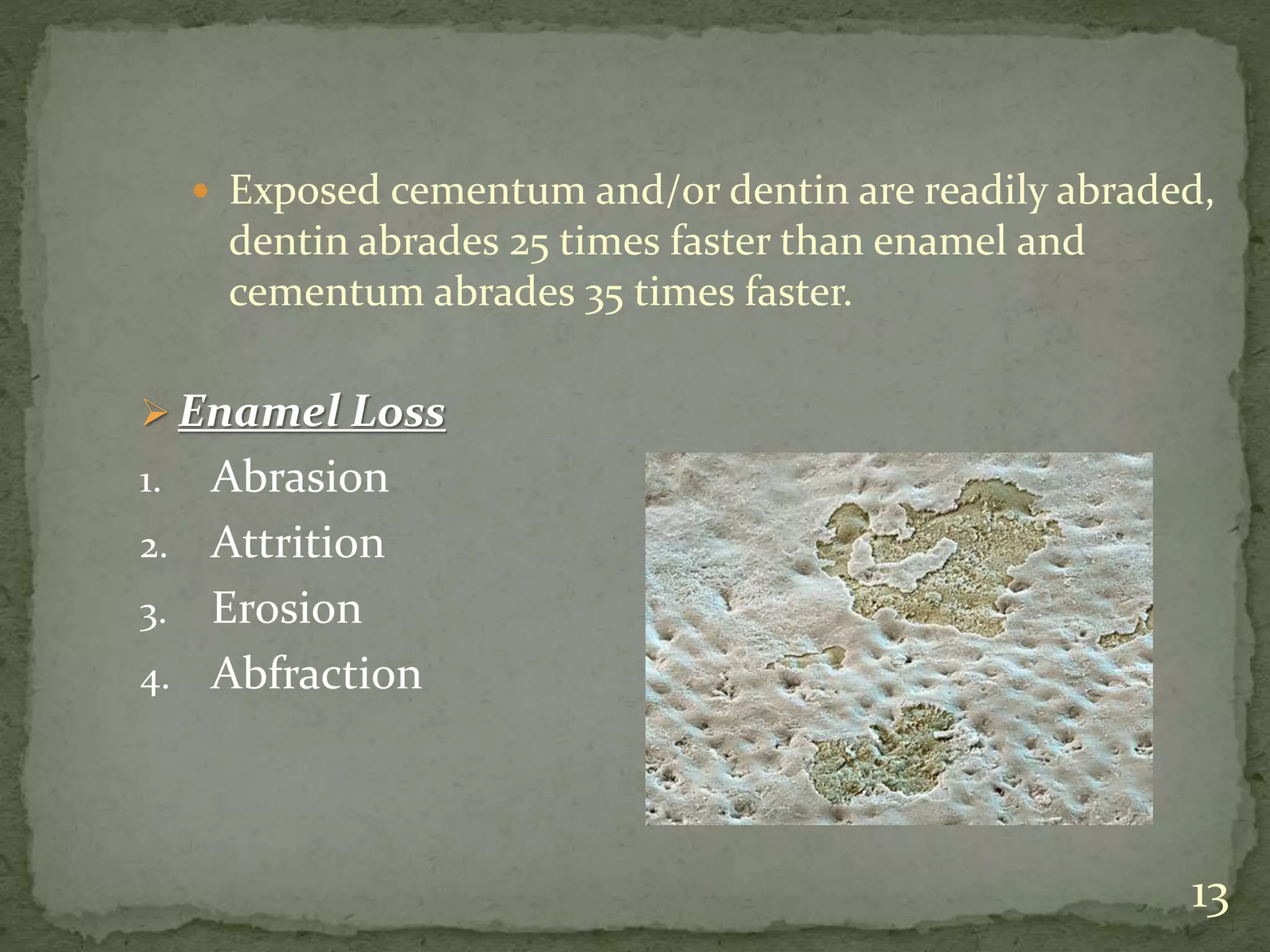  Exposed cementum and/or dentin are readily abraded,
dentin abrades 25 times faster than enamel and
cementum abrades 35 times faster.
 Enamel Loss
1. Abrasion
2. Attrition
3. Erosion
4. Abfraction
13
 