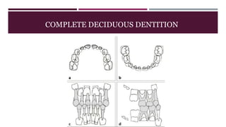COMPLETE DECIDUOUS DENTITION
 