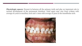Physiologic spaces: Present in between all the primary teeth and play an important role in
normal development of the permanent dentition. Total space may vary from 0-8mm with
average of 4 mm in maxillary arch and 1-7mm with average of 3mm in the mandibular arch.
 