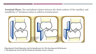 Terminal Plane: The mesiodistal relation between the distal surfaces of the maxillary and
mandibular 2nd deciduous molars is called as terminal plane.
Physiological Tooth Migration And Its Significance For The Development Of Occlusion
I. The Biogenetic Course Of The Deciduous Dentition Louis J. Baume
 