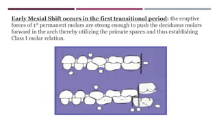 Early Mesial Shift occurs in the first transitional period: the eruptive
forces of 1st permanent molars are strong enough to push the deciduous molars
forward in the arch thereby utilizing the primate spaces and thus establishing
Class I molar relation.
 
