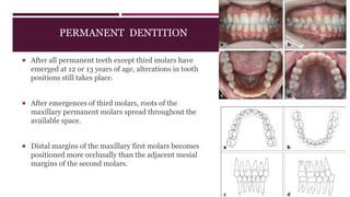 PERMANENT DENTITION
 After all permanent teeth except third molars have
emerged at 12 or 13 years of age, alterations in tooth
positions still takes place.
 After emergences of third molars, roots of the
maxillary permanent molars spread throughout the
available space.
 Distal margins of the maxillary first molars becomes
positioned more occlusally than the adjacent mesial
margins of the second molars.
 