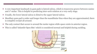  A very important landmark in gum pads is lateral sulcus, which is transverse groove between canine
and 1st molar. This is helpful in predicting inter-arch relation at a very early stage.
 Usually, the lower lateral sulcus is distal to the upper lateral sulcus.
 Maxillary gum pad is wider and longer than the mandibular thus when they are approximated, there
is complete overjet all around.
 The only contact that occurs is around the molar region while space exists in anterior region.
 This is called ‘Infantile Open Bite’ which is considered normal and helpful during suckling.
 