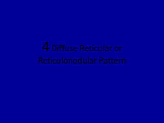 4Diffuse Reticular or
Reticulonodular Pattern
 