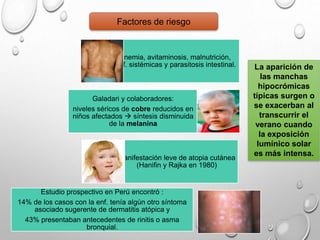 anemia, avitaminosis, malnutrición,
enf. sistémicas y parasitosis intestinal.
Galadari y colaboradores:
niveles séricos de cobre reducidos en
niños afectados  síntesis disminuida
de la melanina
Manifestación leve de atopia cutánea
(Hanifin y Rajka en 1980)
Estudio prospectivo en Perú encontró :
14% de los casos con la enf. tenía algún otro síntoma
asociado sugerente de dermatitis atópica y
43% presentaban antecedentes de rinitis o asma
bronquial.
Factores de riesgo
La aparición de
las manchas
hipocrómicas
típicas surgen o
se exacerban al
transcurrir el
verano cuando
la exposición
lumínico solar
es más intensa.
 