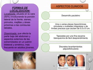 ASPECTOS CLINICOS
Desarrollo paulatino
Una o varias placas hipocrómicas
circulares u ovaladas irregulares y de
límites precisos que oscilan de 0.5 a 5 cm.
Tapizadas por una fina escama
blanquecina de fácil desprendimiento
Discretos levantamientos
pápulofoliculares
FORMAS DE
LOCALIZACION:
Localizada: situada en la cara
(50%) involucrando la porción
lateral de la frente, sienes,
pómulos, mejillas y áreas
próximas a las comisuras
labiales.
Diseminada: que afecta la
parte baja del abdomen y
aspectos externos de las
extremidades en un patrón
bilateral y simétrico, más
frecuente en adultos jóvenes.
 
